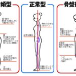 骨盤を立てて歩きましょう