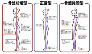 骨盤を立てて歩きましょう