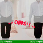 コシラックとО脚