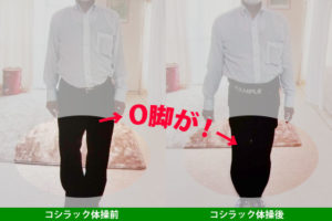 コシラックとО脚