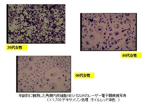 年齢別に観測した角膜内皮細胞
